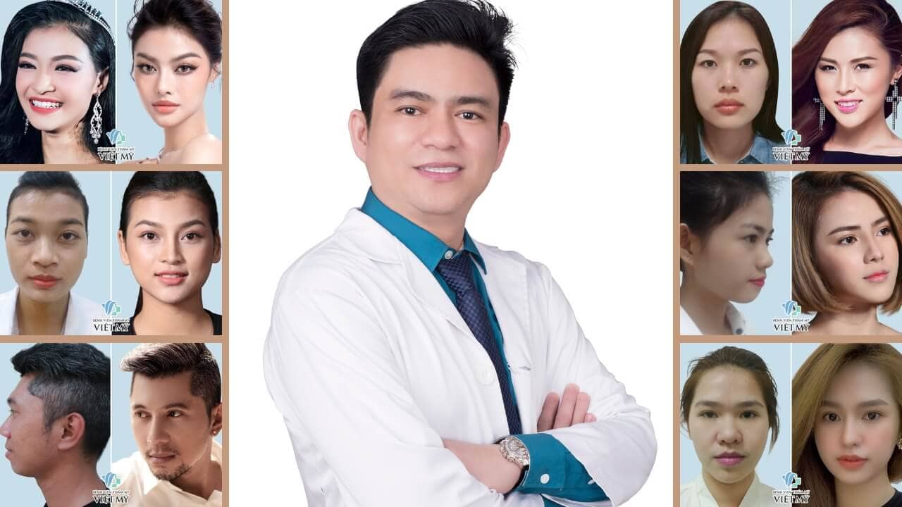 Các dáng mũi đẹp Tìm hiểu về những kiểu dáng mũi phổ biến và được yêu thích