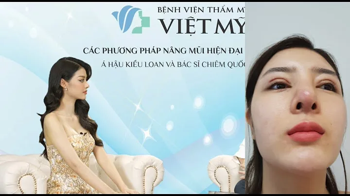 Bọc Sụn Megaderm Nâng Mũi Cấu Trúc Tinh Tế Với Kỹ Thuật Hiện Đại Bọc Sụn Megaderm Nâng Mũi Cấu Trúc Tinh Tế Với Kỹ Thuật Hiện Đại boc sun megaderm nang mui cau truc tinh te voi ky thuat hien dai 65f51146902c8