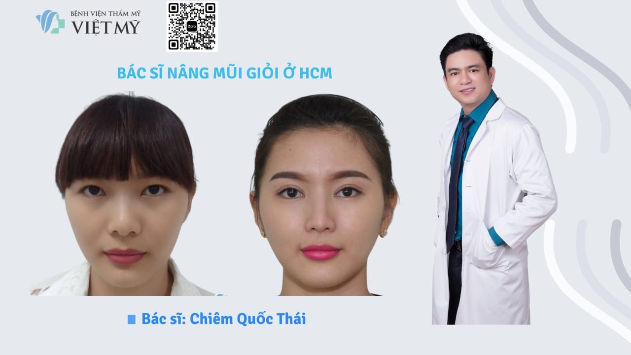 Dáng Mũi Đẹp Là Gì? Cách Chọn Phù Hợp Từng Khuôn Mặt