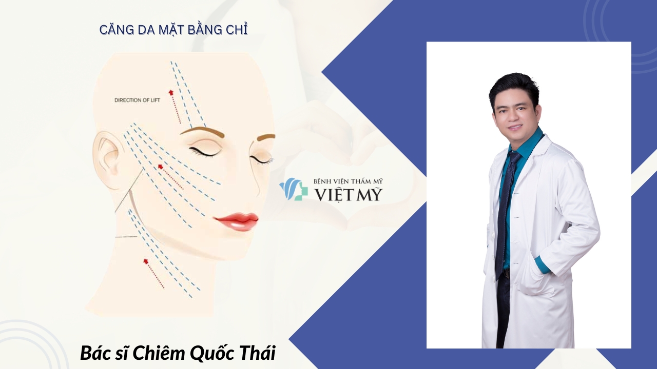 Căng da mặt bằng chỉ collagen: Sự Thật, Hiệu Quả & Khi Nào KHÔNG Nên Làm (2026) cang da mat bang chi Benh vien tham my Viet My