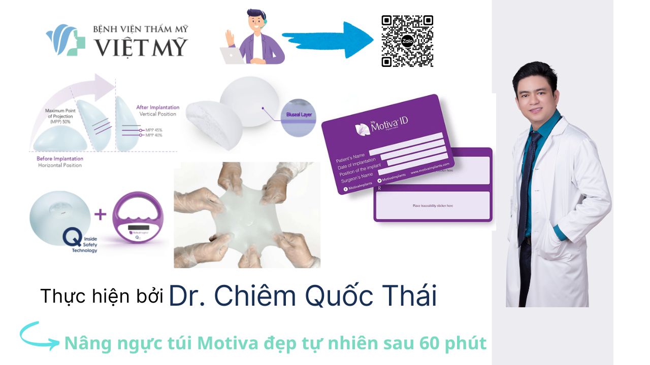 Túi ngực Nano Chip Ergonomix (còn gọi là túi Motiva Ergonomix) 