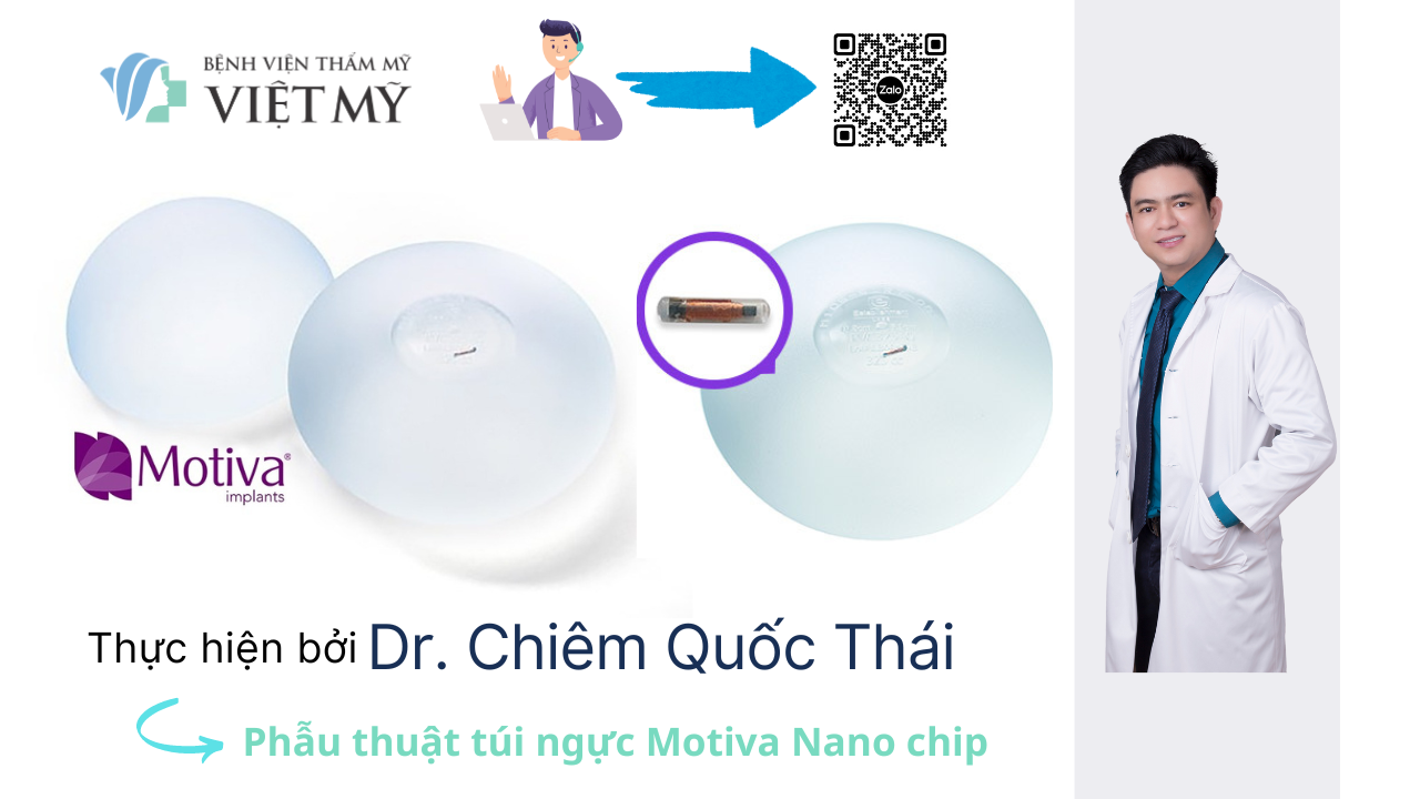 So sánh các loại túi ngực Motiva, Mentor, Ergonomix 2, Perle và IMPLEO