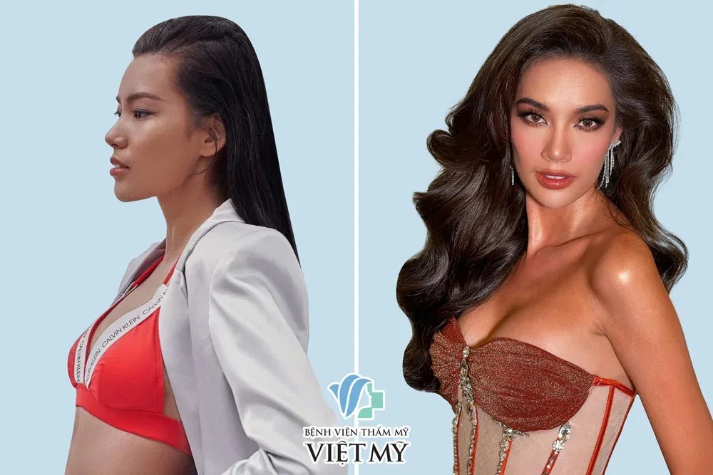 Ngực to hay nhỏ phụ thuộc vào khung người và tỷ lệ vóc dáng