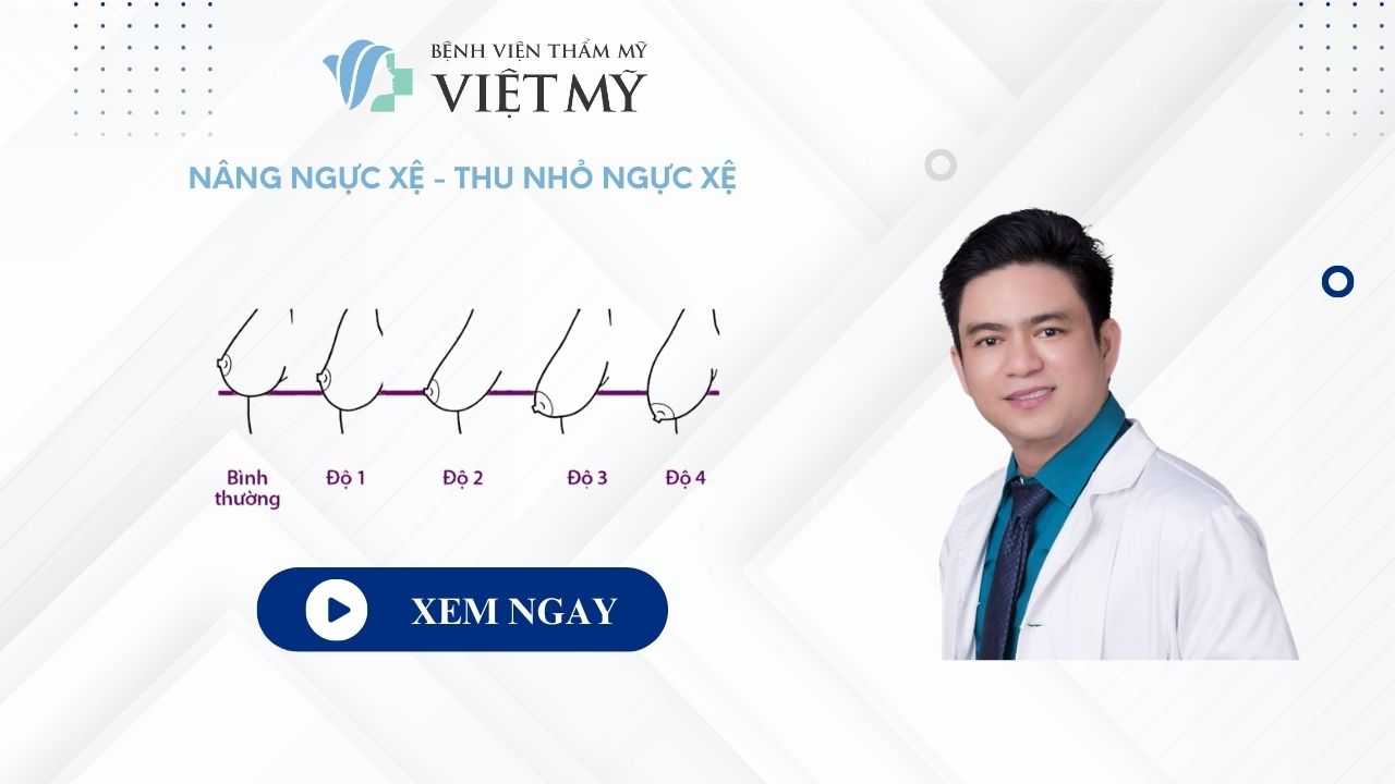 Nâng ngực sa trễ tại Bệnh viện Thẩm mỹ Việt Mỹ