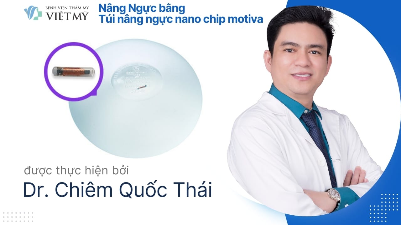 Nâng Ngực Nano Chip Motiva Nội Soi Tại Việt Mỹ Túi ngực Motiva có chip thông minh hỗ trợ truy xuất thông tin implant