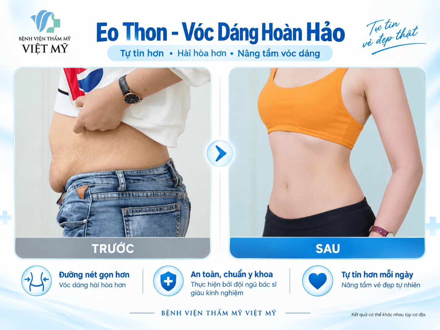 Trang chủ V3.2 Hút mỡ bụng