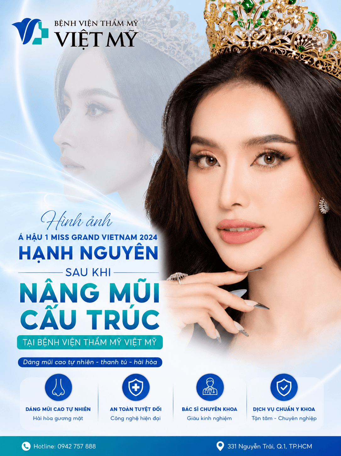 Trang chủ V3.2 Nâng mũi