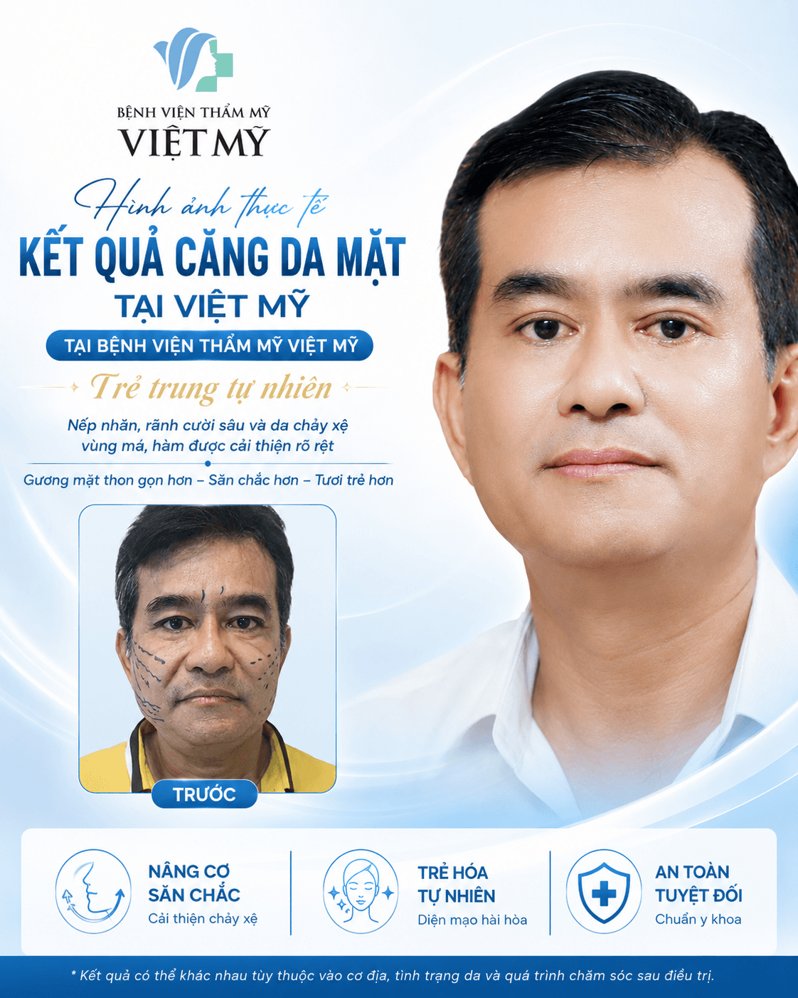 Trang chủ V3.2 Căng da