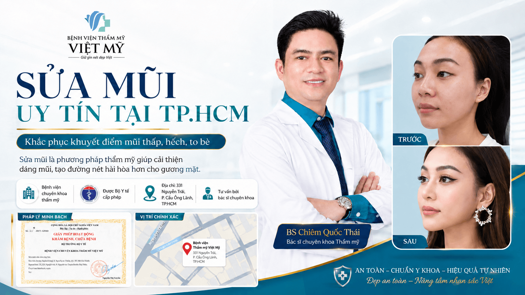 Trang chủ V3.2 Sua mui la phuong phap tham my giup khac phuc khuyet diem thap hech to be