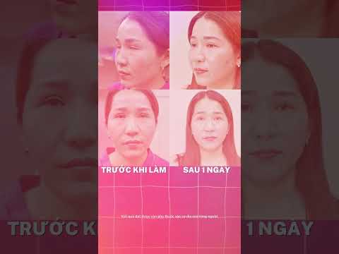 Video Bệnh viện Thẩm mỹ Việt Mỹ