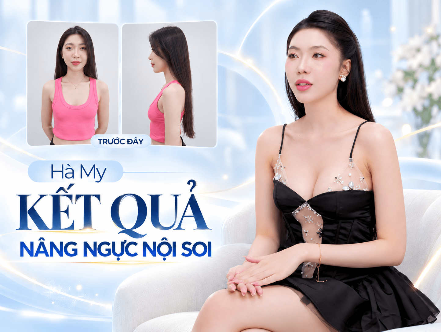 Nâng ngực nội soi