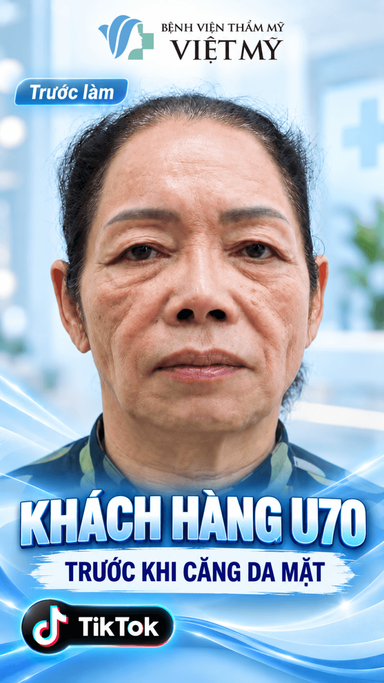 Khách hàng U70 trước khi căng da mặt tại Bệnh viện Thẩm mỹ Việt Mỹ