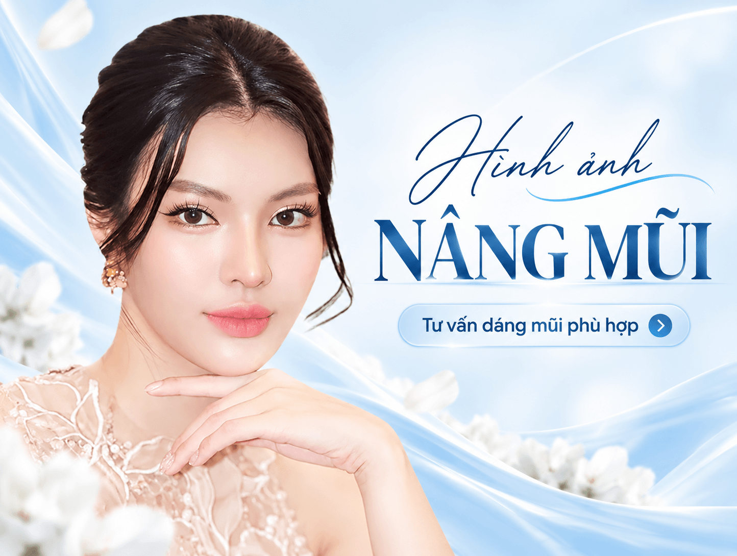 Nâng mũi