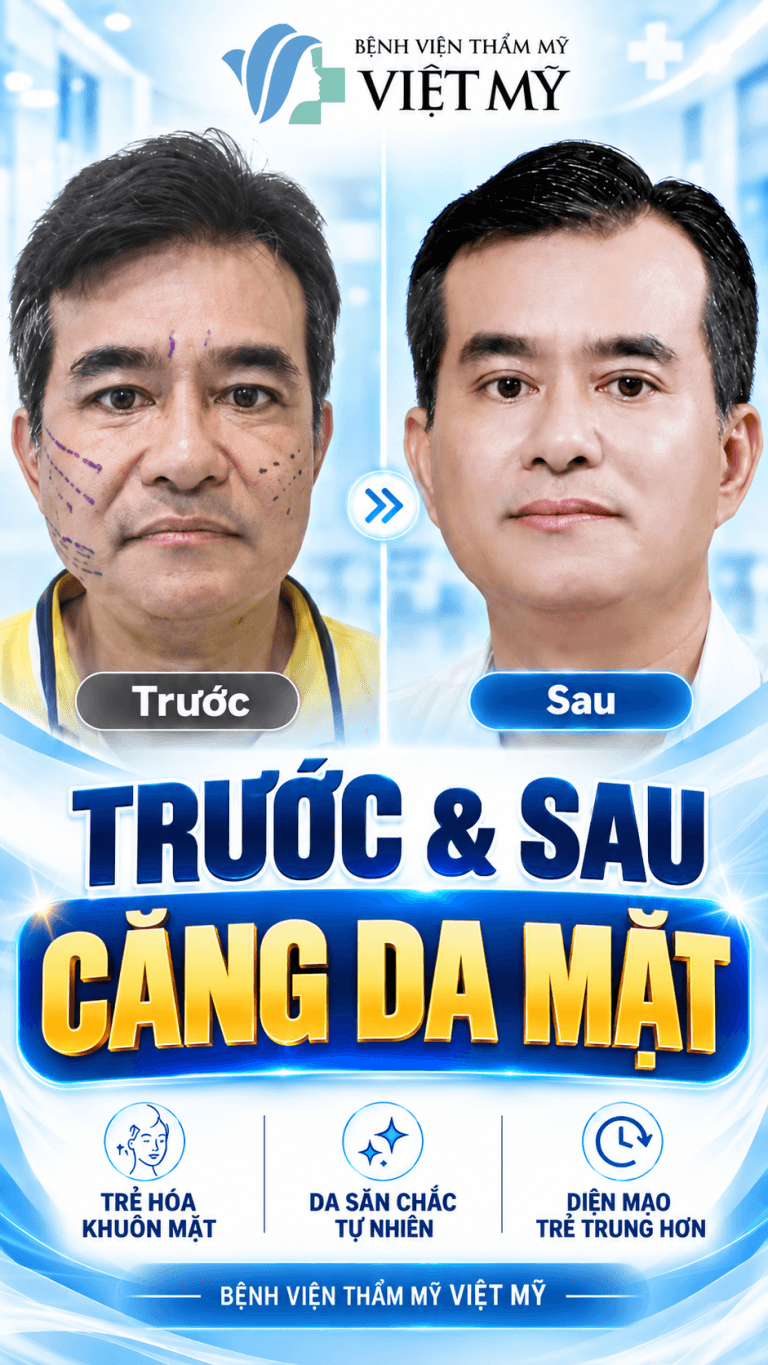 BS Chiêm Quốc Thái tư vấn căng da mặt tại Bệnh viện Thẩm mỹ Việt Mỹ